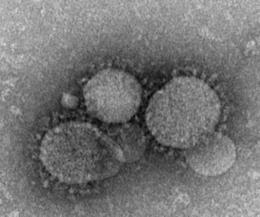 Virus MERS CoV en microscopía electrónica. (Wikimedia Commons)