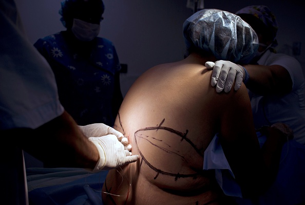 Aquí una paciente de 27 años se prepara para una cirugía de bariátrica en un centro de la clínica, el 16 de octubre de 2014, en Cali, Colombia (Photo credit should read LUIS ROBAYO / AFP / Getty Images)