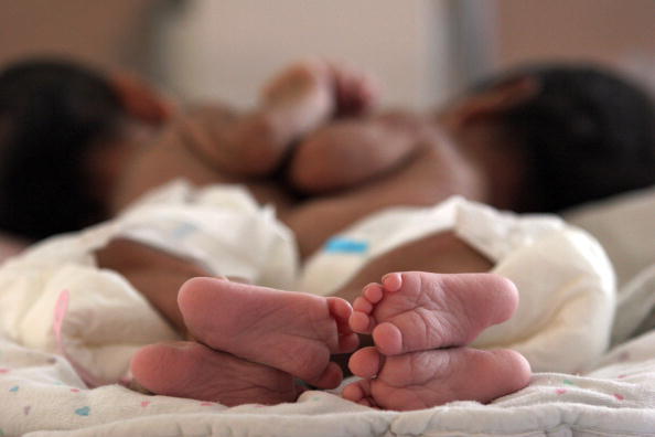Si un gemelo sufre cáncer, el otro tiene más riesgo de padecerlo (estudio).  (ORLANDO SIERRA/AFP/Getty Images)