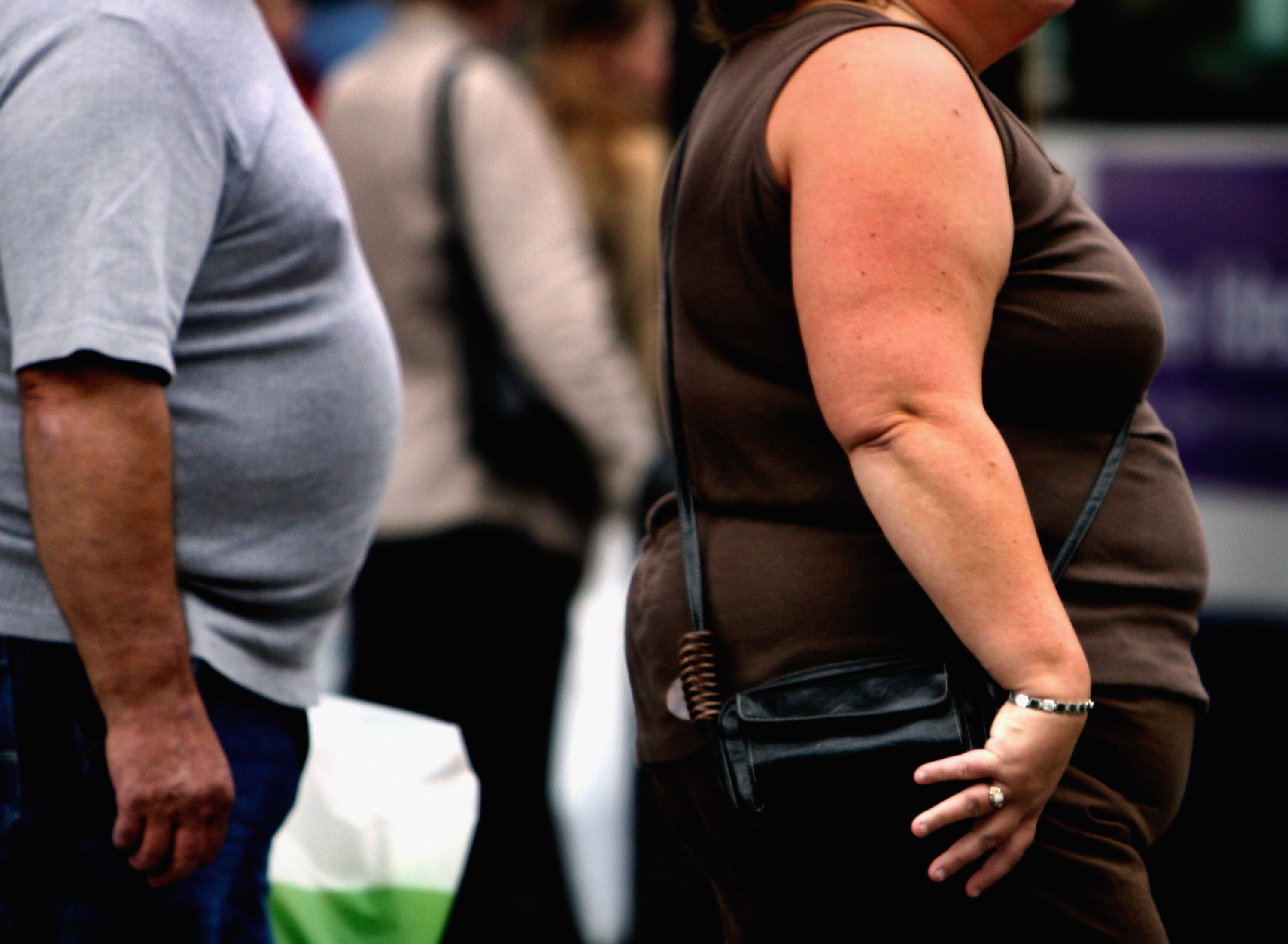 La obesidad ya ha sido declarada como epidemia de salud a nivel mundial y parece ser que con el paso de los años irá empeorando. Un nuevo estudio asegura que en 2025 una de cada cinco personas será obesa. A continuación te dejamos algunos de los factores que debemos tener en cuenta para prevenir esta enfermedad (Photo by Jeff J Mitchell/Getty Images)