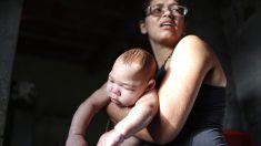 Zika puede causar defectos en miles de bebés