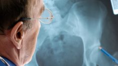 Protección contra la osteoporosis: Los factores de riesgo y los métodos de prevención tradicionales