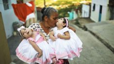 Científicos de EEUU logran evitar contagio de zika en madres pero no en fetos