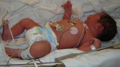 Bebé abortada fue abandonada para morir en la basura del hospital; 36 años después conoce a su madre