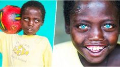 Aunque en la escuela se burlan de él, el mundo ama los increíbles ojos azules de este niño etíope