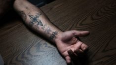 Argentina: Joven toma radical decisión y se borra tatuaje del brazo con un rallador de queso
