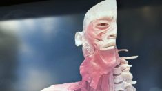 Asociaciones de profesionales instan al gobierno de Australia a investigar la controvertida exhibición ‘Real Bodies’