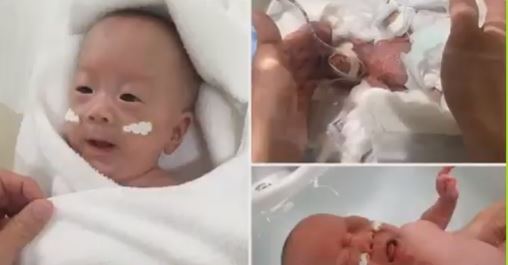 Bebe más prematuro del mundo fue dado de alta del Hospital Keio en Japón (Captura de vídeo)