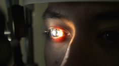 Golpe de una cuerda elástica en el ojo de este hombre dejó su iris colapsado