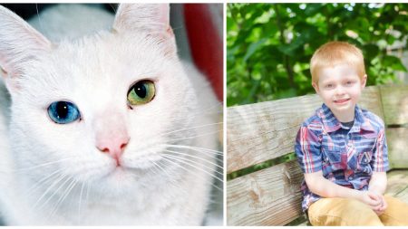 Niño y gato acosados por su rara condición ocular y labio leporino se hacen mejores amigos