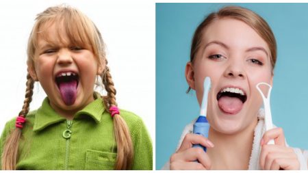 13 cosas que tu lengua dice sobre tu salud: «Lengua roja y brillante debes consultar a tu médico»