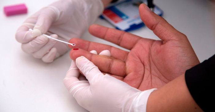Prueba instantánea de VIH (Virus de Inmunodeficiencia Adquirida). (CLAUDIO REYES/AFP/Getty Images)