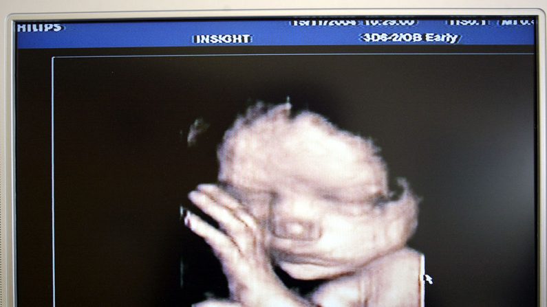 La ecografía Phillips 3D que muestra a un niño no nacido en Insight Radiology, Nueva Zelanda. (Michael Bradley/Getty Images)
