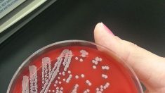 Investigadores identifican a una bacteria como causa del prurito de la piel
