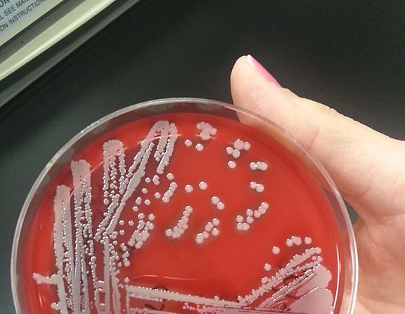 Foto de un cultivo de bacteria llamada Staphylococcus aureus. Wikipedia.