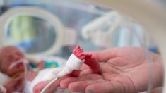 Bebé prematuro nace con la piel tan “transparente” que su madre puede ver su circulación sanguínea