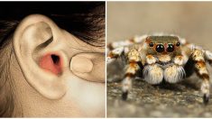 El dolor de oído de una mujer resulta ser una araña que ha estado viviendo ahí adentro