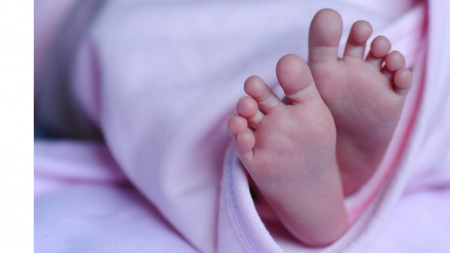 India: Bebé nace con cuatro piernas y tres manos al unirse con su mellizo en útero
