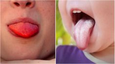 13 cosas que el color de la lengua dice de tu salud, si la tienes roja brillante consulta a un médico