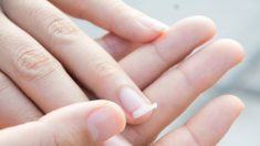 Advertencia de una mujer se vuelve viral al descubrir que las uñas curvadas son una señal de cáncer