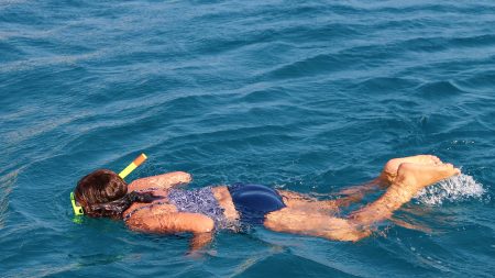 Una niña de 16 años sufre graves quemaduras de sol en la espalda luego de bucear en el Caribe