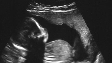 Administração Trump adverte Hospital que forçou enfermeira católica a ajudar em aborto