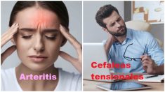 10 tipos de dolor de cabeza y cómo tratarlos, el número 9 no lo debes ignorar