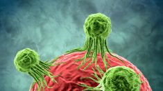 Tratamento de médicos da USP faz desaparecer células de linfoma
