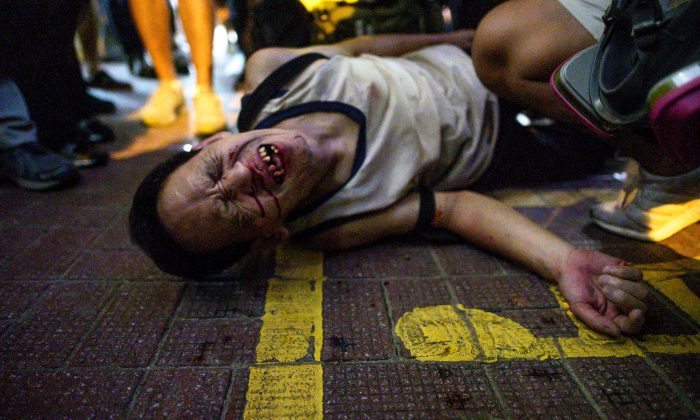 Um homem não identificado reage após ser espancado por um grupo de pessoas após um protesto no distrito de Causeway Bay, em Hong Kong, em 15 de setembro de 2019 (Philip Fong / AFP / Getty Images)