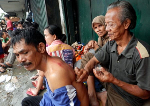 Homem recebe uma massagem de cunhagem (Bay Ismoyo / AFP / Getty Images)