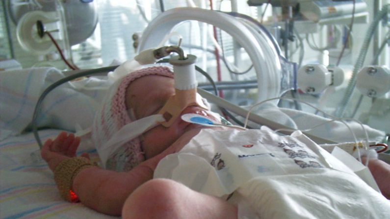 Bebé prematuro en una incubadora. Imagen de archivo. (Wikimedia)