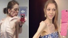 À beira da morte, adolescente anoréxica que pesava 24 kg é salva pelo fisiculturismo