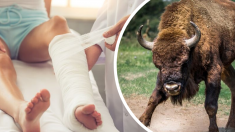 Hombre atacado por un bisonte regresa de nuevo al parque estatal y ahora la embestida es para su novia