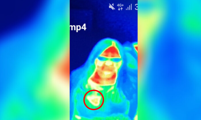 Una foto del teléfono inteligente de una imagen térmica que muestra los puntos calientes de Bal Gill; El punto amarillo en la imagen es el cáncer de mama. (Cortesía de Camera Obscura y World of Illusions)