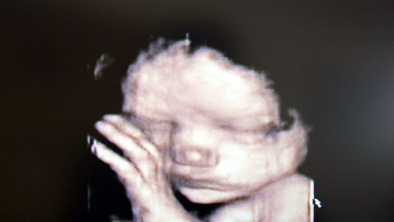 Um ultrassom 3D mostrando o bebê dentro do útero (Fotopress / Getty Images)