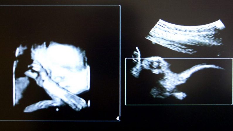 Ultra-som de um bebê por nascer (Michael Bradley / Getty Images)