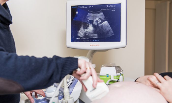 Foto ilustrativa, un médico realiza una ecografía a una mujer embarazada durante su visita a un ginecólogo. (Jennifer Jacobs/AFP/Getty Images)