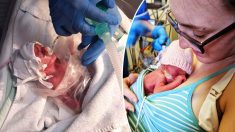 Bebé prematura que nació 4 meses antes de tiempo sobrevive a su diagnostico de 48 horas de vida
