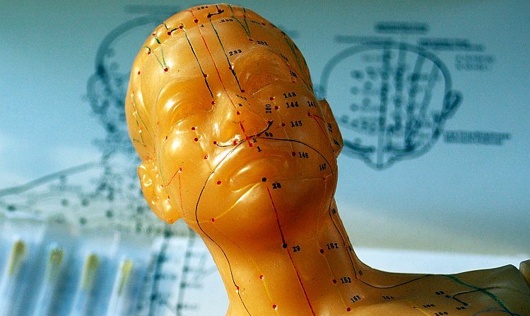 Los acupunturistas deben poder ver el cuerpo a través de "gafas cuánticas" para comprender este antiguo sistema de tratamiento. (Crédito: Cat Rooney / The Epoch Times)
