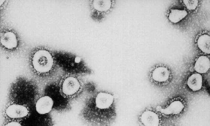 Esta foto sin fecha de los Centros para el Control y la Prevención de Enfermedades (CDC) muestra una vista microscópica del coronavirus en el CDC de Atlanta, Georgia. Según el CDC el virus que causa el Síndrome Respiratorio Agudo Severo (SARS) podría ser un "virus no reconocido previamente de la familia del coronavirus". (CDC/Getty Images)