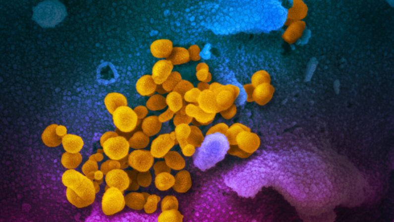 Imagen de un microscopio electrónico de barrido muestra el virus que causa COVID-19 aislado de un paciente en los Estados Unidos, emergiendo de la superficie de las células (azul/rosa) cultivadas en el laboratorio. (NIAID-RML/CC BY 2.0)