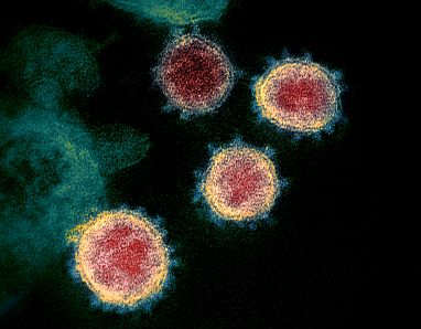Micrografía electrónica  de un paciente de transmisión de partículas aisladas del virus del PCCh, o virus SARS-CoV-2 el virus que causa el COVID-19. (NIAID)
