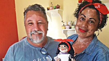 Abuelo teje muñecas con vitiligo para niñas que sufren de esta rara enfermedad de la piel