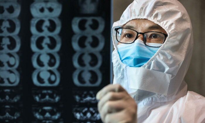 Un doctor mira una imagen de radiología de pulmón en un hospital del condado de Yunmeng, en la ciudad de Xiaogan, en la provincia central de Hubei, el 20 de febrero de 2020. (STR/AFP a través de Getty Images)