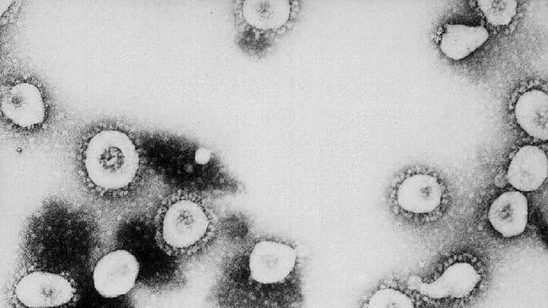 Esta foto sin fecha de los Centros para el Control y la Prevención de Enfermedades (CDC) muestra una vista microscópica del nuevo coronavirus en los CDC en Atlanta, Georgia. Según los CDC, el virus que causa el Síndrome Respiratorio Agudo Severo (SRAS) podría ser un "virus no reconocido previamente de la familia Coronavirus". (CDC / Getty Images)
