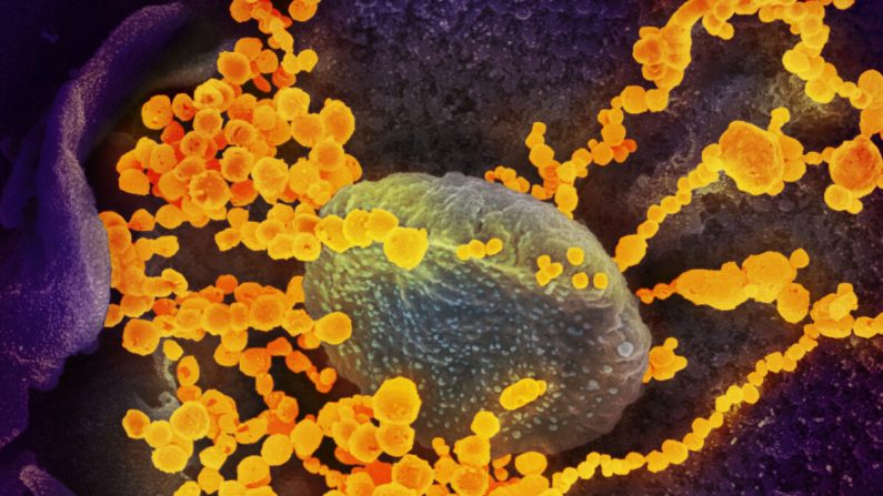 Esta imagen de microscopio electrónico de barrido muestra al virus del PCCh, (objetos redondos amarillentos) emergiendo de la superficie de las células cultivadas en el laboratorio.  El virus que se muestra fue tomado de un paciente en EE.UU. Foto publicada el 19 de febrero de 2020. (NIAID-RML)
