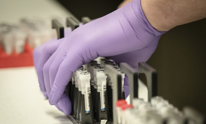 Las muestras se analizan para detectar virus respiratorios en una fotografía de archivo. (Danny Lawson/Pool/AFP a través de Getty Images)