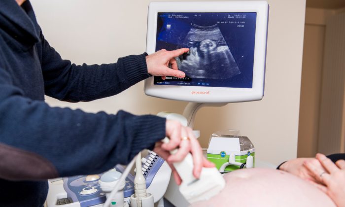 Examen de ultrasonido de una mujer embarazada. (Jasper Jacobs/AFP/Getty Images)