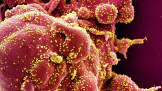 Estudio: Virus reactivados tras COVID-19 y su vacuna pueden estar relacionados con la linfopenia
