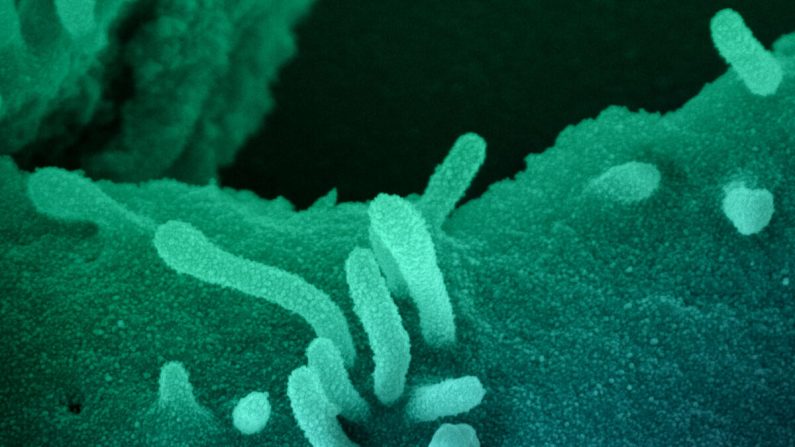 Esta imagen de microscopio electrónico de barrido muestra a un conjunto de coronavirus SARS-CoV-2, a los que el medio The Epoch Times se refiere como el virus del PCCh, vistos como objetos redondos de color magenta, elemergiendo de la superficie de las células cultivadas en el laboratorio. (NIAID-RML)